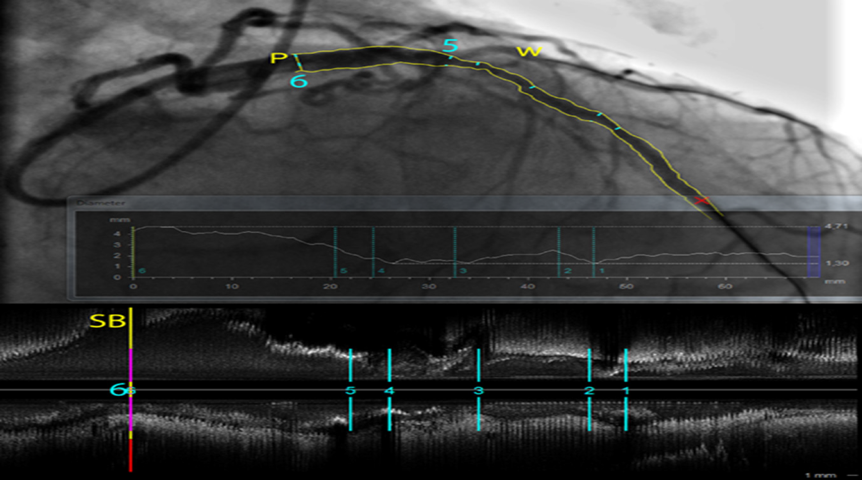 legrand wolf ultrasound