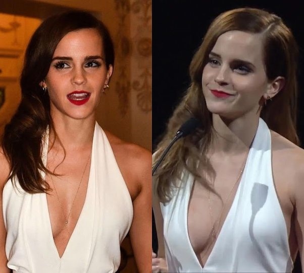 denis chiasson add emma watson porn vid photo