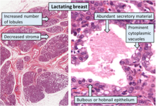 al bromberg recommends Sucking Lactating Breasts