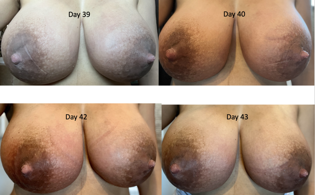 andrew mundt recommends massive lactating breasts pic