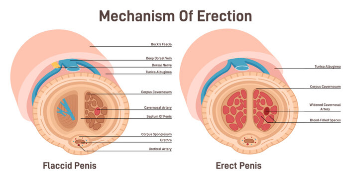 abel miclat add photo male erection picture