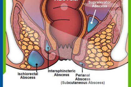 brent boschetti recommends Anal And Swallowing