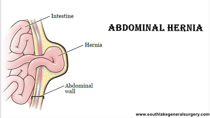 danang raditya recommends anal tummy bulge pic