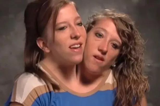 brianna lomas recommends lesbian twin porn videos pic