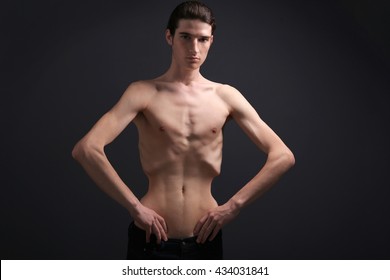 diane lovullo recommends anorexic twinks pic