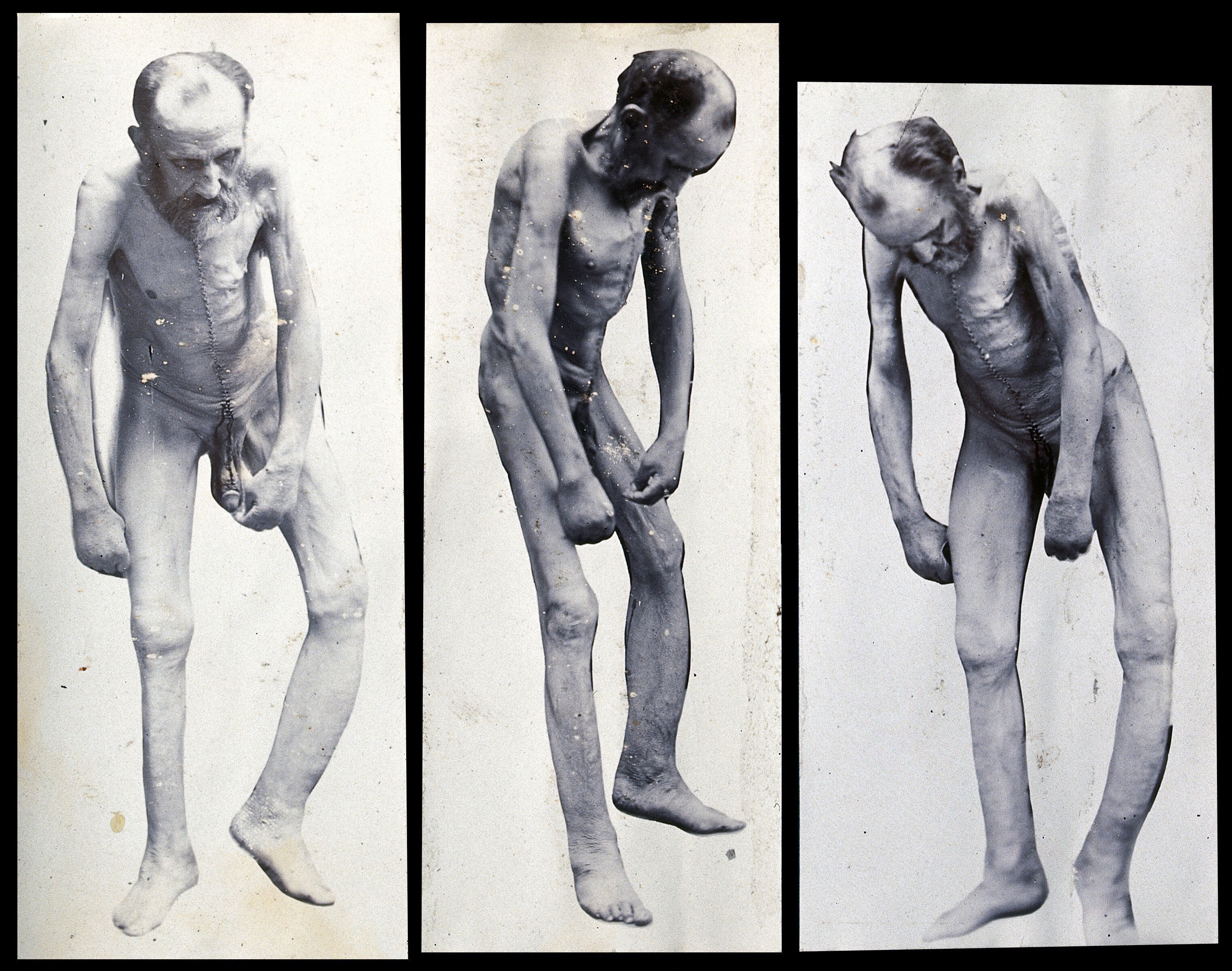 images of naked old men