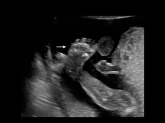 alexia soto share legrand wolf ultrasound photos