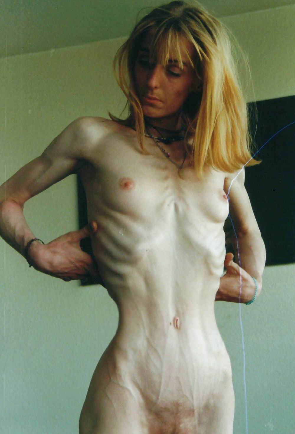 cara chandler recommends nude anorexic women pic