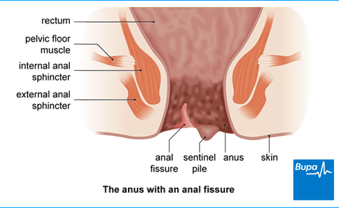 allan lerios recommends Painful Anal Forced Porn