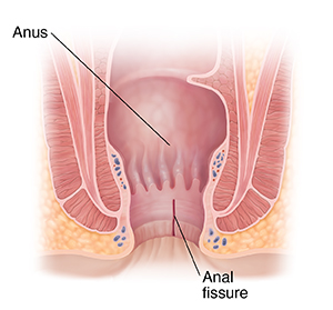 christy farney recommends painful anal forced porn pic