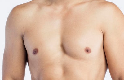 cipto leksono recommends puffy nipple matures pic